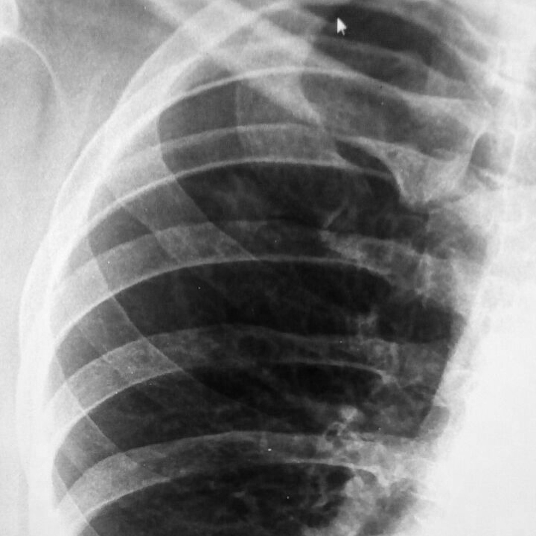 russianradiology в LOOKY — фото 7