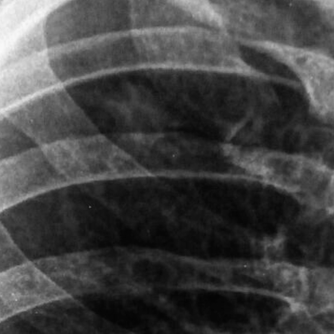 russianradiology в LOOKY — фото 8