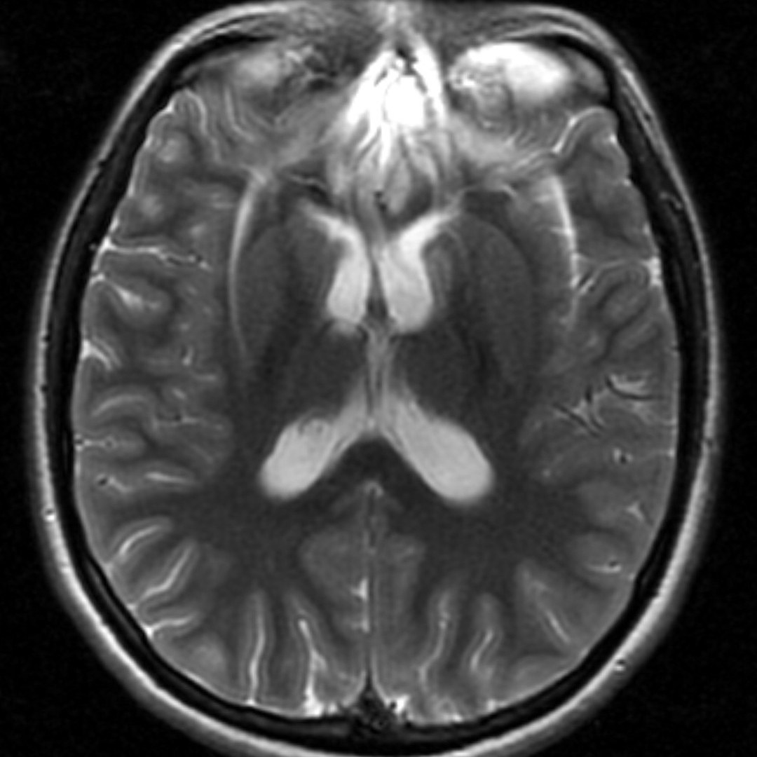 russianradiology в LOOKY — фото 5