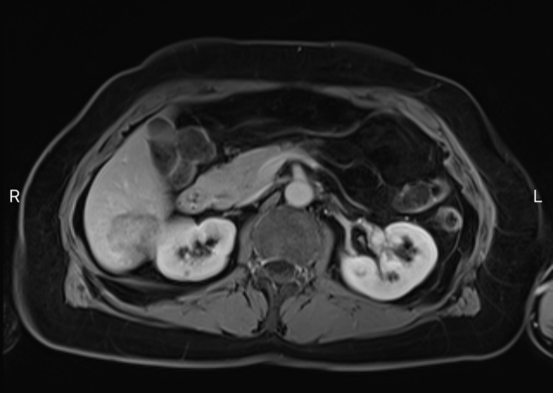 russianradiology в LOOKY — фото 10