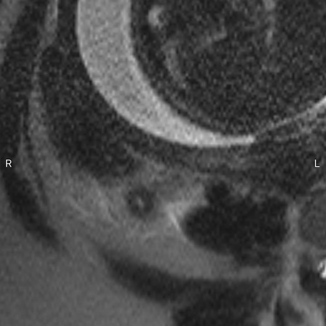 russianradiology в LOOKY — фото 4