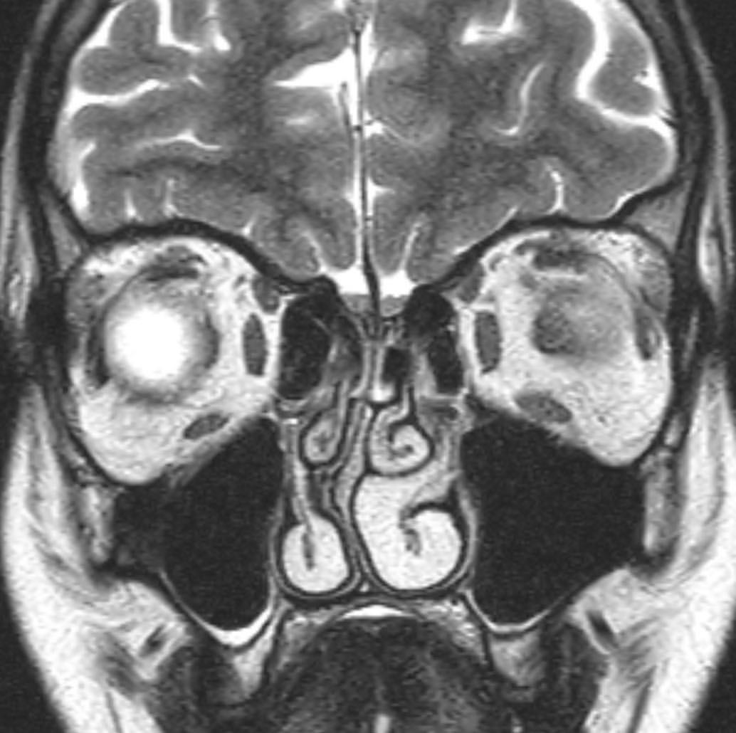 russianradiology в LOOKY — фото 3