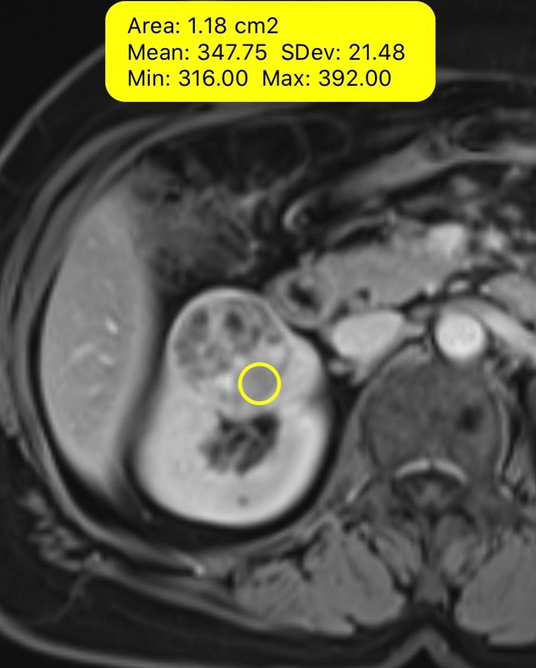 russianradiology в LOOKY — фото 4