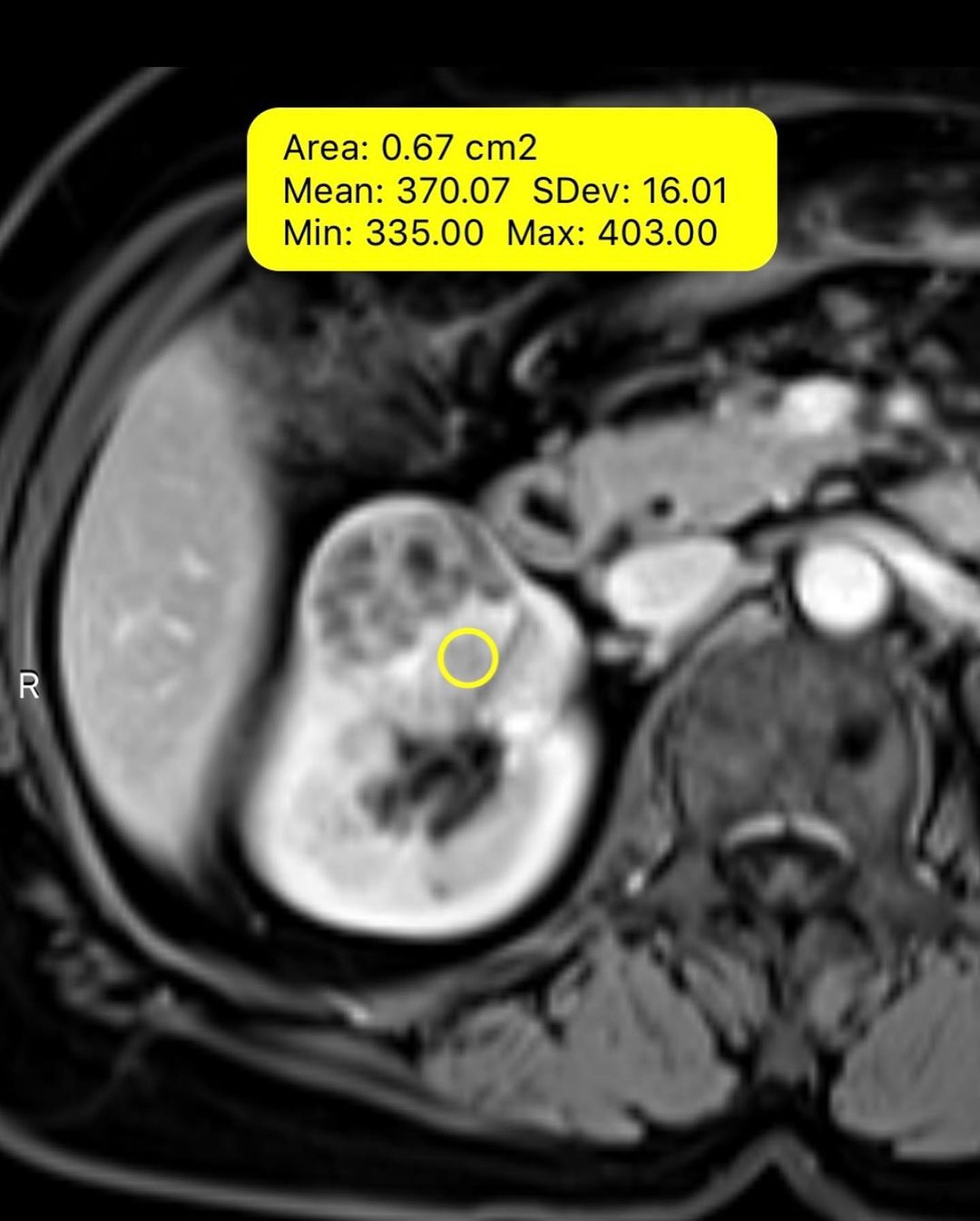 russianradiology в LOOKY — фото 3