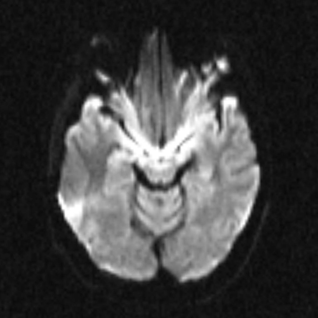 russianradiology в LOOKY — фото 10