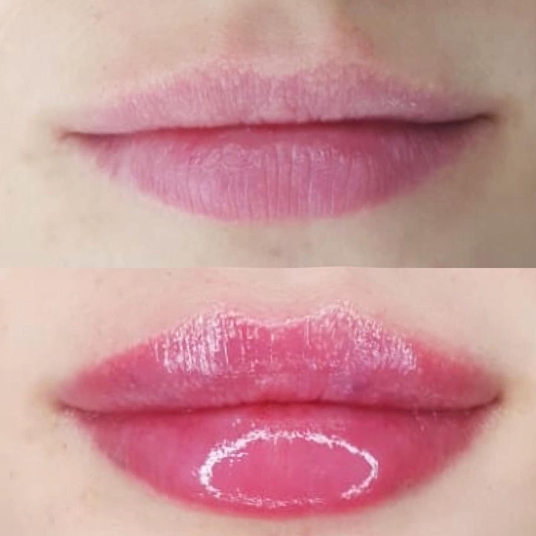 lipsstudio_ekb в LOOKY — Первичная коррекция губ 💉
Длительность процедуры : 40 минут