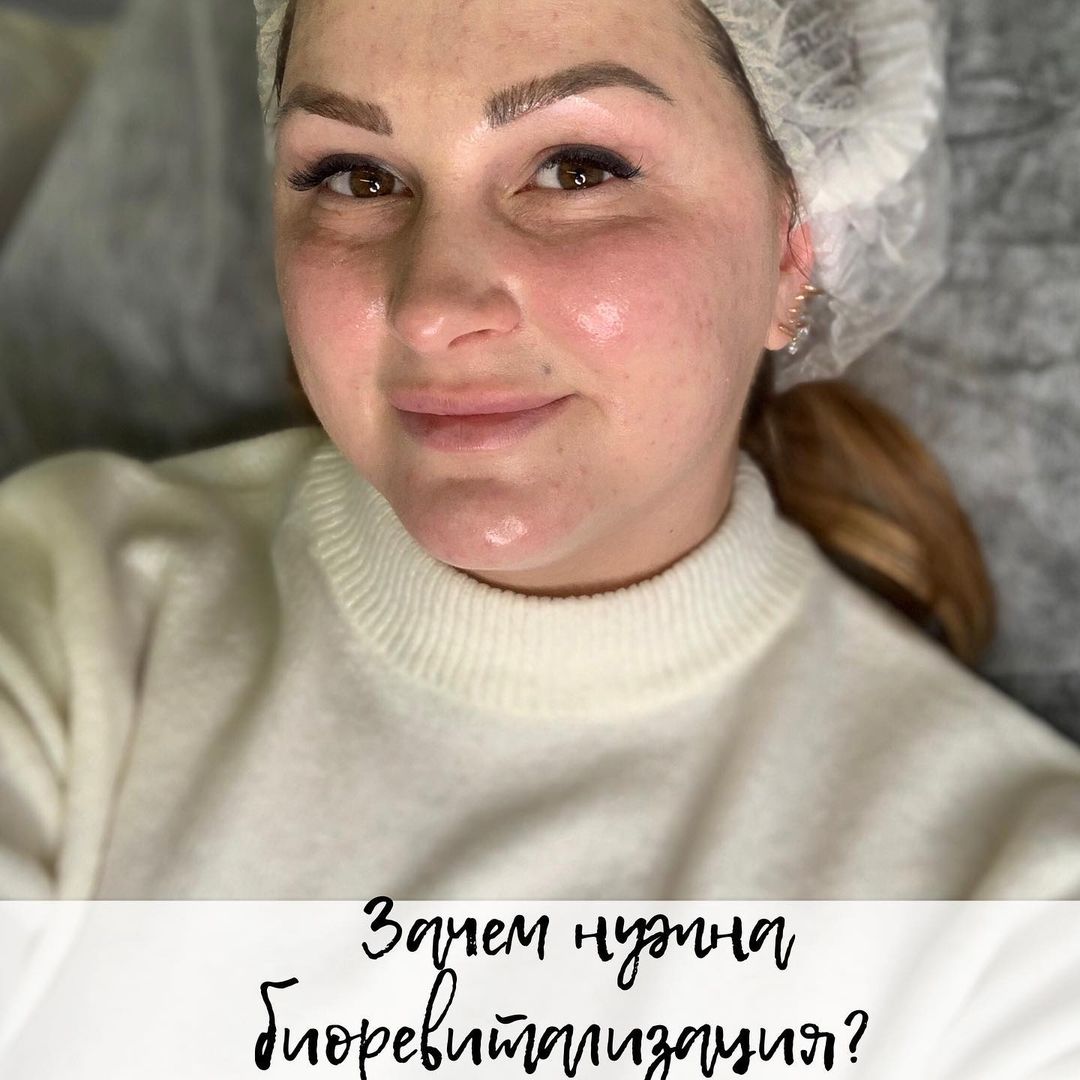 alexa_beauty_blog в LOOKY — Зачем нужна процедура биоревитализации?
⠀
А вы знали, что ка