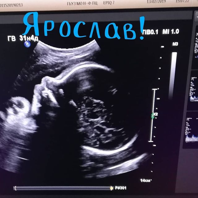 ksenia.k_nova в LOOKY. #ярослав,#человексолнце,#happyfamily,#soul,#mysoul,#itsaboy,#momofabestson,#мамалучшегомальчика,#солнышко. Ровно год назад мы п...