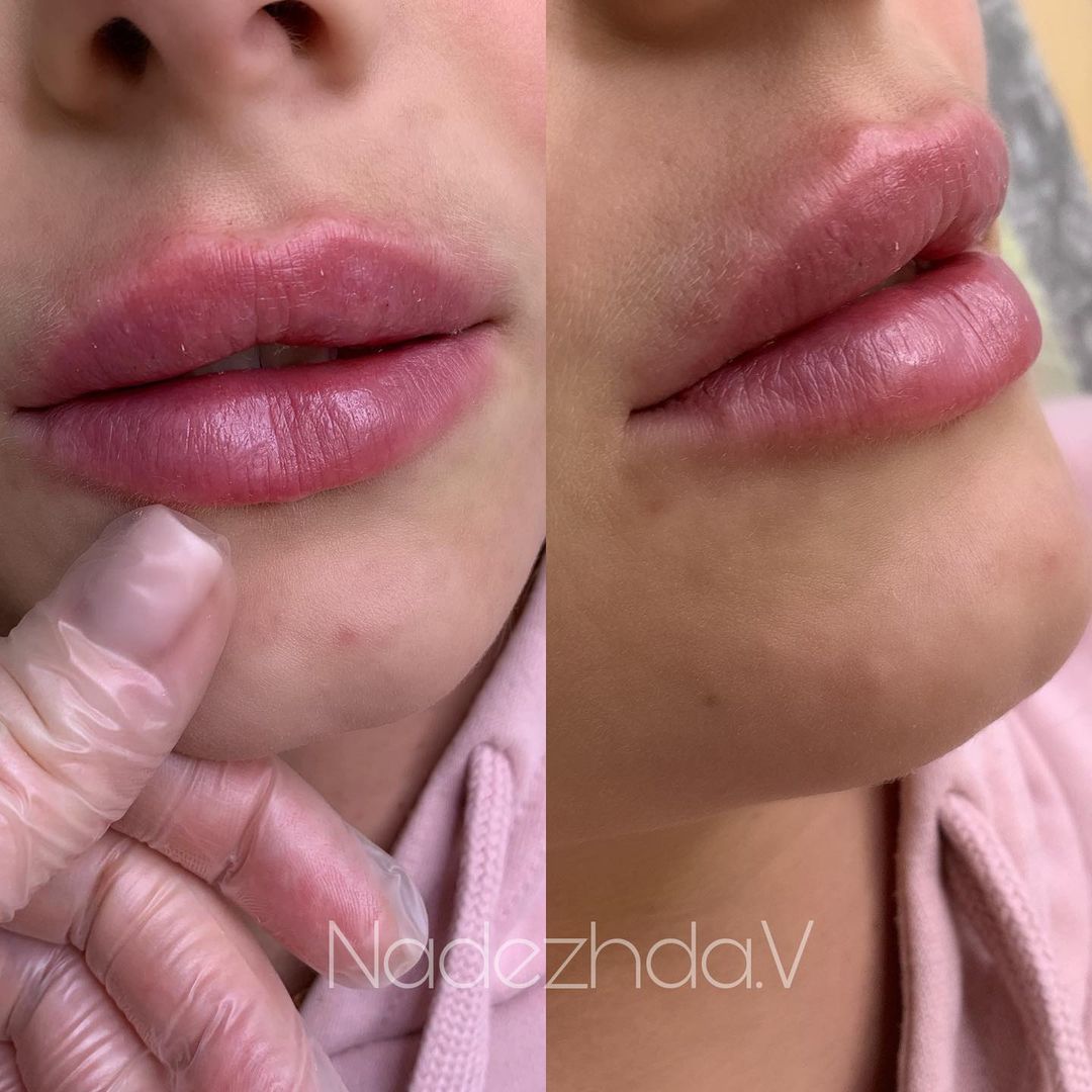 kosmetologyst__nvrs в LOOKY — Я за естественность 💋
⠀
Если вы тоже, ставьте ❤️❤️❤️ Спасиб