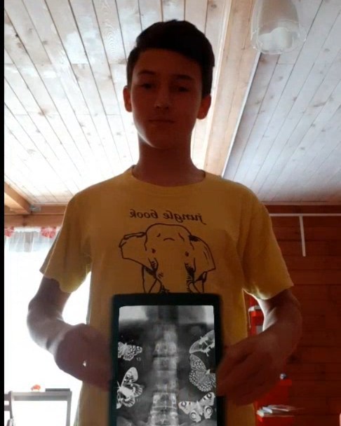 plastinin_grisha в LOOKY. #butterflies,#xray,#x-ray,#trand,#video,#instagram,#russia. INSIDE
.
.
.
.
.
.
....