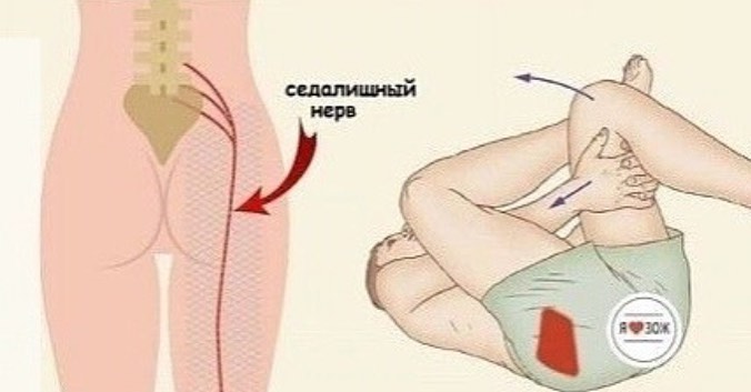 milaolshh в LOOKY — Если защемило седалищный нерв,поможет данное упражнение на р
