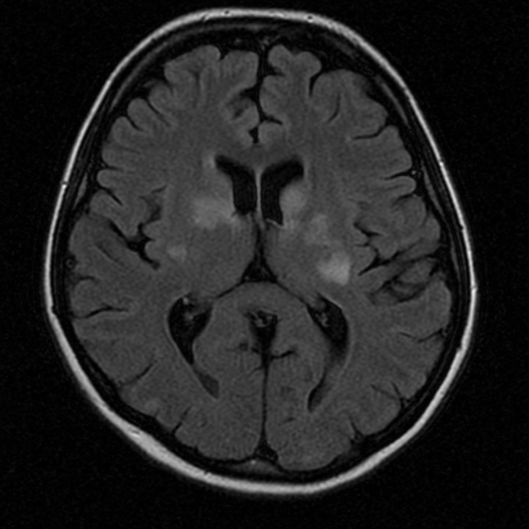 russianradiology в LOOKY — фото 7