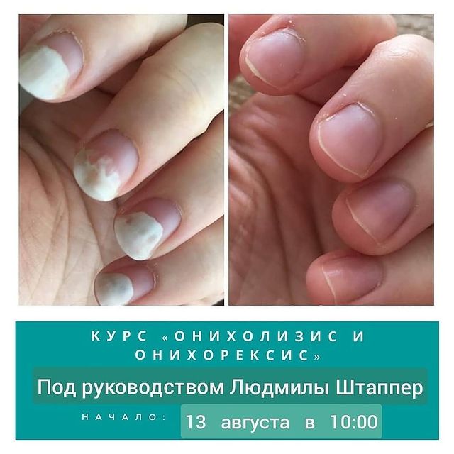 lyudmila78911 в LOOKY. #аппаратныйпедикюр,#маникюркамышин,#аппаратныйманикюр#педикюркамышин,#ногтикамышин,#аппаратныйманикюркамышин,#аппаратныйпедикюркамышин,#inkikamyshin. 13 августа приглашае...