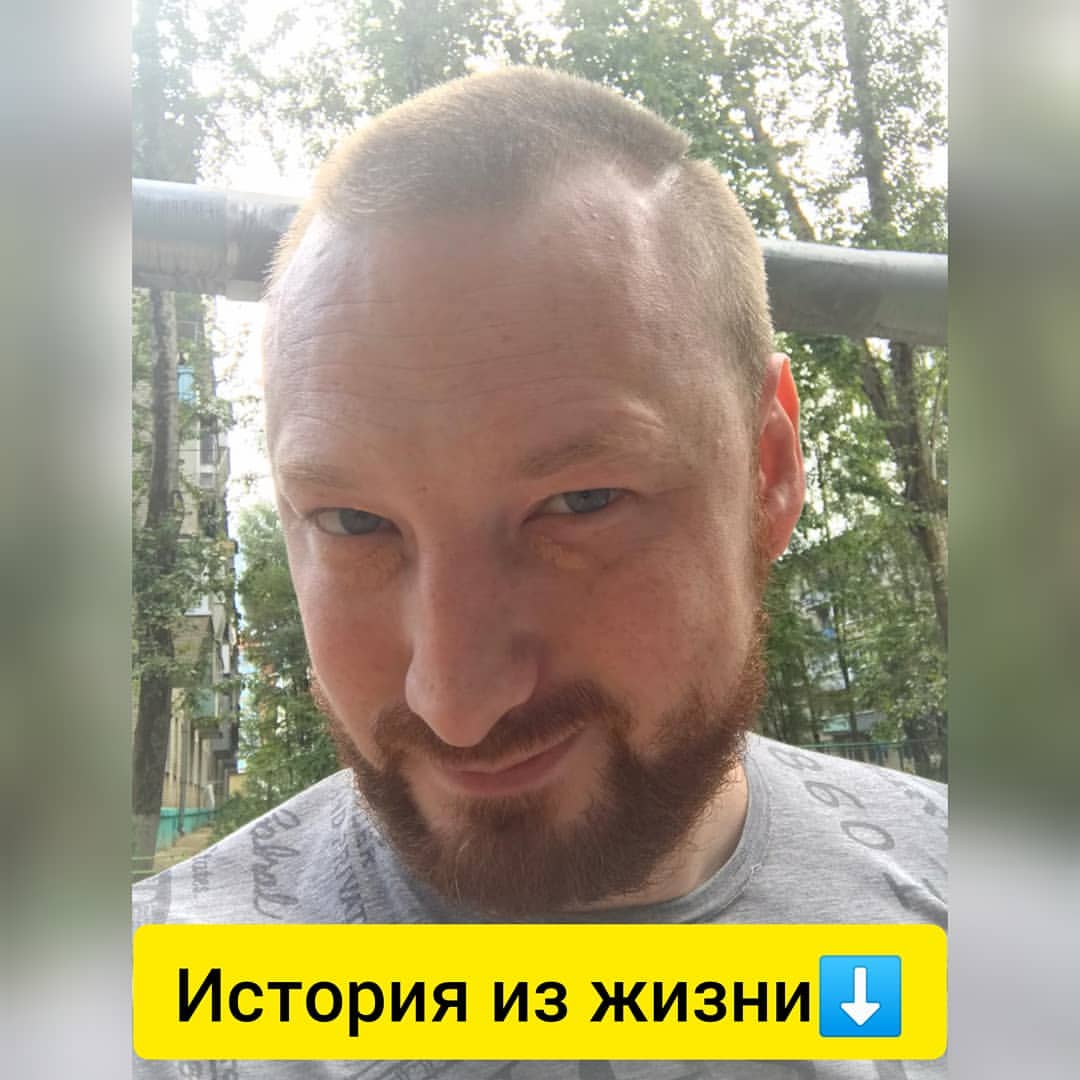 💣ИСТОРИЯ... Стрижка-Вспышка! 
Это был обычный день и ничего, сука, не предвещало "беды"!⚡Я как обычно встал, покушал и решил сходить в парикмахерскую, навести красоту, ведь мужчина красив, когда хорошо подстрижен и ухожен, чего нельзя было сказать обо мне в то утро.👹Вообщем, я оделся и пошел в свою завсегдатую "стрижелку". Там, как обычно, меня встречала шикарная Армянская женщина, во всей красе, которая мне всегда наводит красоту на бошке, она меня называет 🐻медвежонок Денис🐻, я ее называю, как всегда ✂️Драсти,а можно подстричься?✂️Вообщем, обмен любезностями. Но сегодня ее не было, вместо нее была не менее эстетичная женщина, с большими холмами, прекрасным акцентом и потрясающей улыбкой.😁За 3 года, что я там стригусь, уже наверное все парихмахеры знали, как меня стрич. На вопрос: " Стричься будем как обычно?" Я отвечаю, что мне хочется что-то нового, Она с улыбкой ответила: " Я тебя поняла". Тетя без замедления и колебаний берет машинку с насадкой 3мм и хлоднокровно ОТХЕРАЧИВАЕТ мне кусок волос... Аха.. я даже не знал что и сказать, к такому я точно не был готов! Увидев, что я сижу побледневший и в полуоброчном состоянии, добрая армянская тетя с улыбкой произнесла: " Нэ пэрэживай, щас все будет красиво" и под напевание одной, из как я понял,армянских традиционных мотивов, принялась меня крамсать дальше, а я в свою очередь, в ожидании глобального пиздеца, уселся поудобнее в кресло и начал ждать, ощущая на своей бошке елозиния машинки,  напевов тети и паралельно напевающего Стаса Михайлова из радио. Мои ожидания заняли от силы минут 5 и вот я с новой умопомрачительной трехмиллимитровой стильной прической, готов покорять сердца и взгляды девушек, так сказала добрая армянская тетя закончив меня злобно кромсать. Сделав элегантный пирует расчёской мне по лбу, она профессионально произнесла: " Последний штрих". В этот момент тремор в моем глазу херачил лезгинку😵.Но потом вошел мой парихмахер, она подошла ко мне по ближе, на ее лице вырисовывались слезы от смеха, но она себя сдерживала и просто сказала: " Вам таааак хорошо"😁😁. Я ей рассказал всю ситуацию, мы вместе посмеялись я расплатился и пошел домой, в отличном настроении, которое продлилось целый день.👍