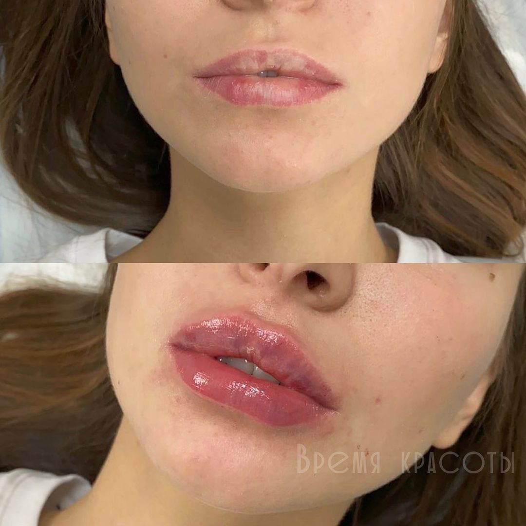 dr.ozdoeva_sv в LOOKY — БЕЗ ФОТОШОПА
⠀
Это политика Центра косметологии «Время красо