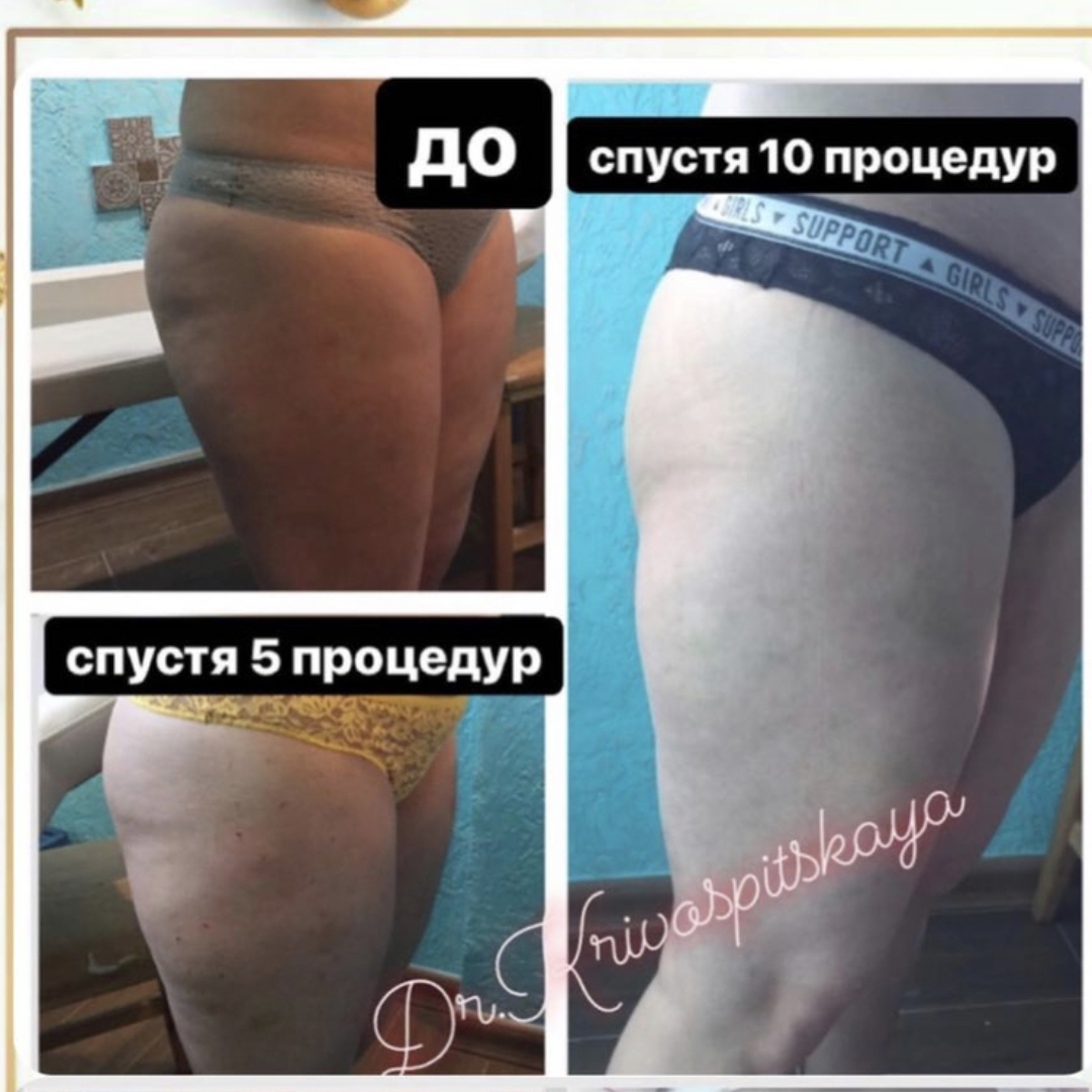 kate_medicale в LOOKY — ХВАТИТ ЭТО ТЕРПЕТЬ!!!
⠀
Приводите своё Тело в порядок, сей