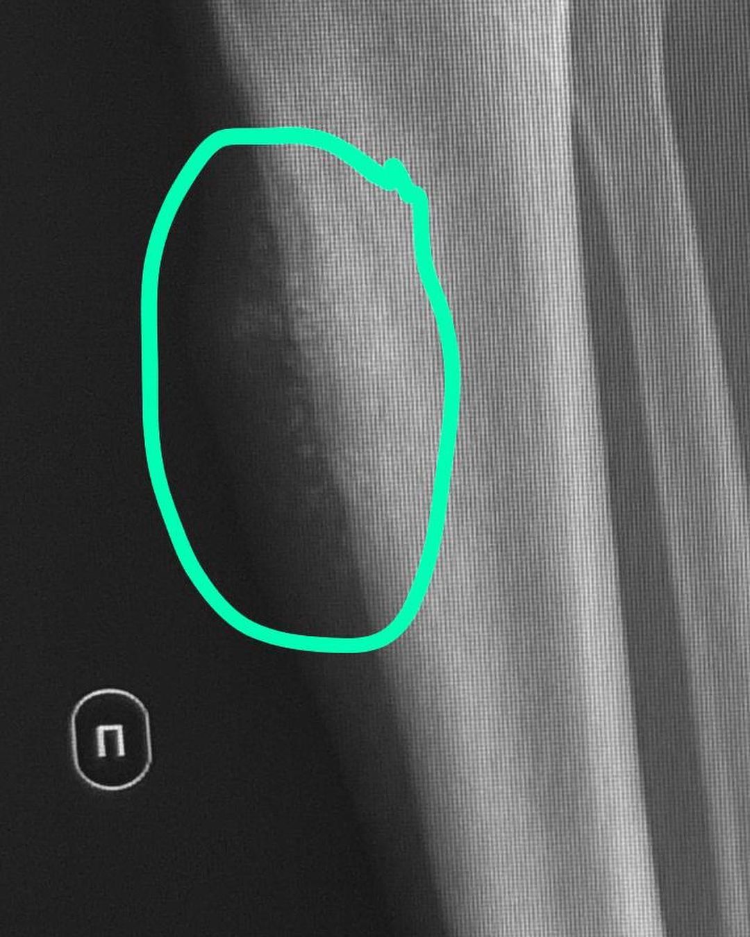 russianradiology в LOOKY — фото 10