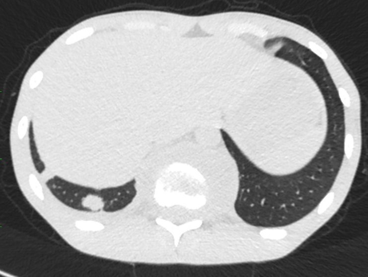 russianradiology в LOOKY — фото 10