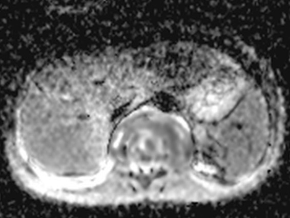 russianradiology в LOOKY — фото 6