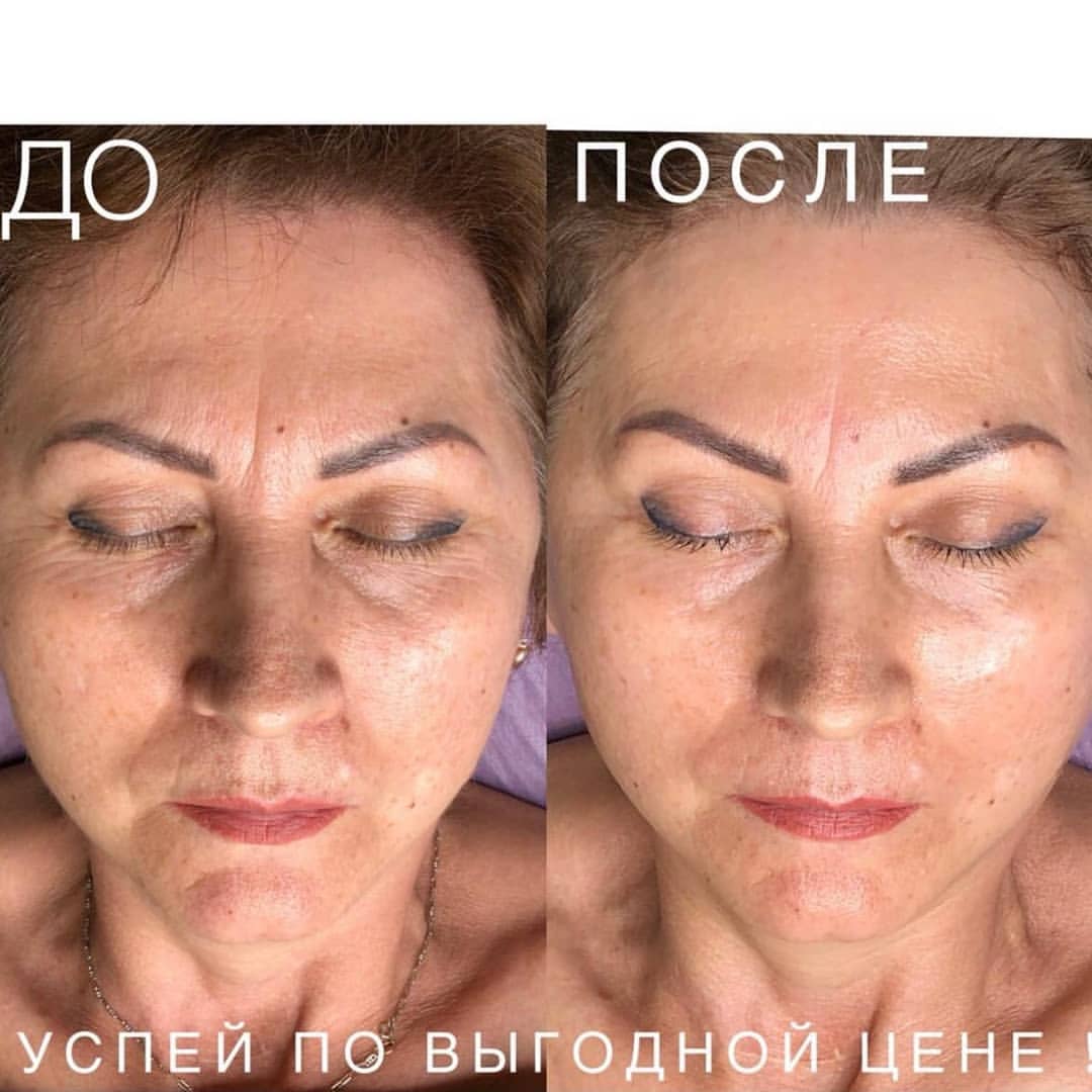 beauty_cosmetolog_ru в LOOKY — фото 1