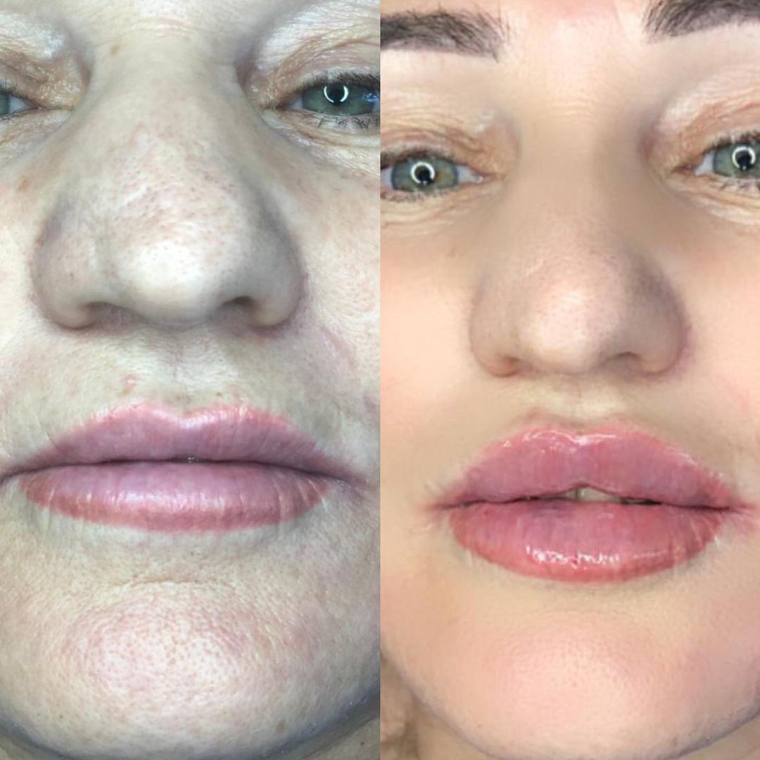 dr_cosmetolog_medzhidova в LOOKY — Что мы только не используем для того, чтобы наши губки были 