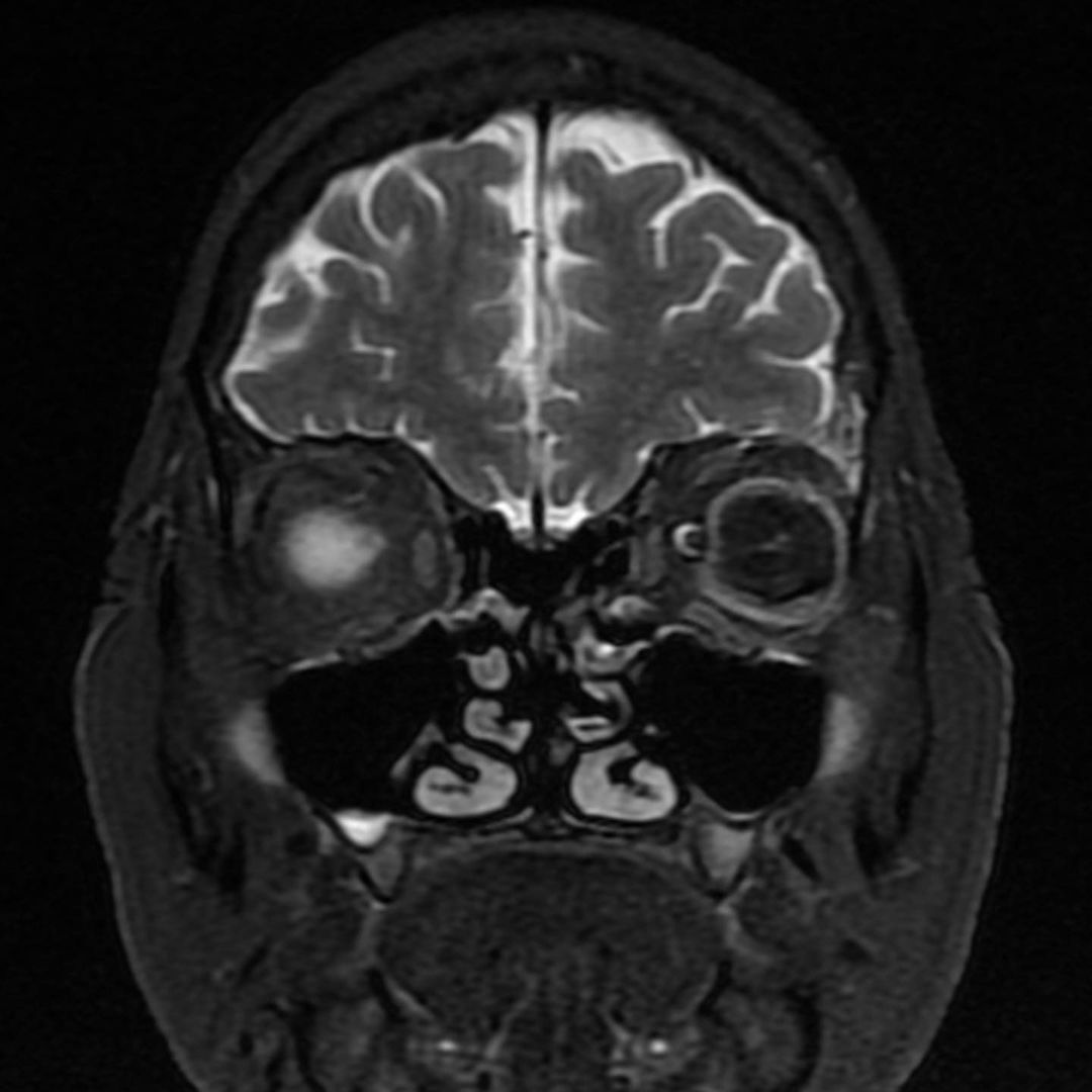 russianradiology в LOOKY — фото 5