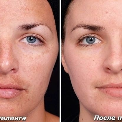 beauty_cosmetolog_ru в LOOKY — фото 4