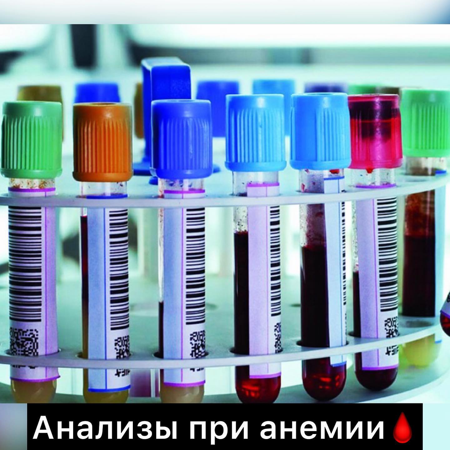 cosmetolog_verba в LOOKY — АНАЛИЗЫ ПРИ АНЕМИИ 🩸
⠀
📌Вот какие анализы в идеале нужно с