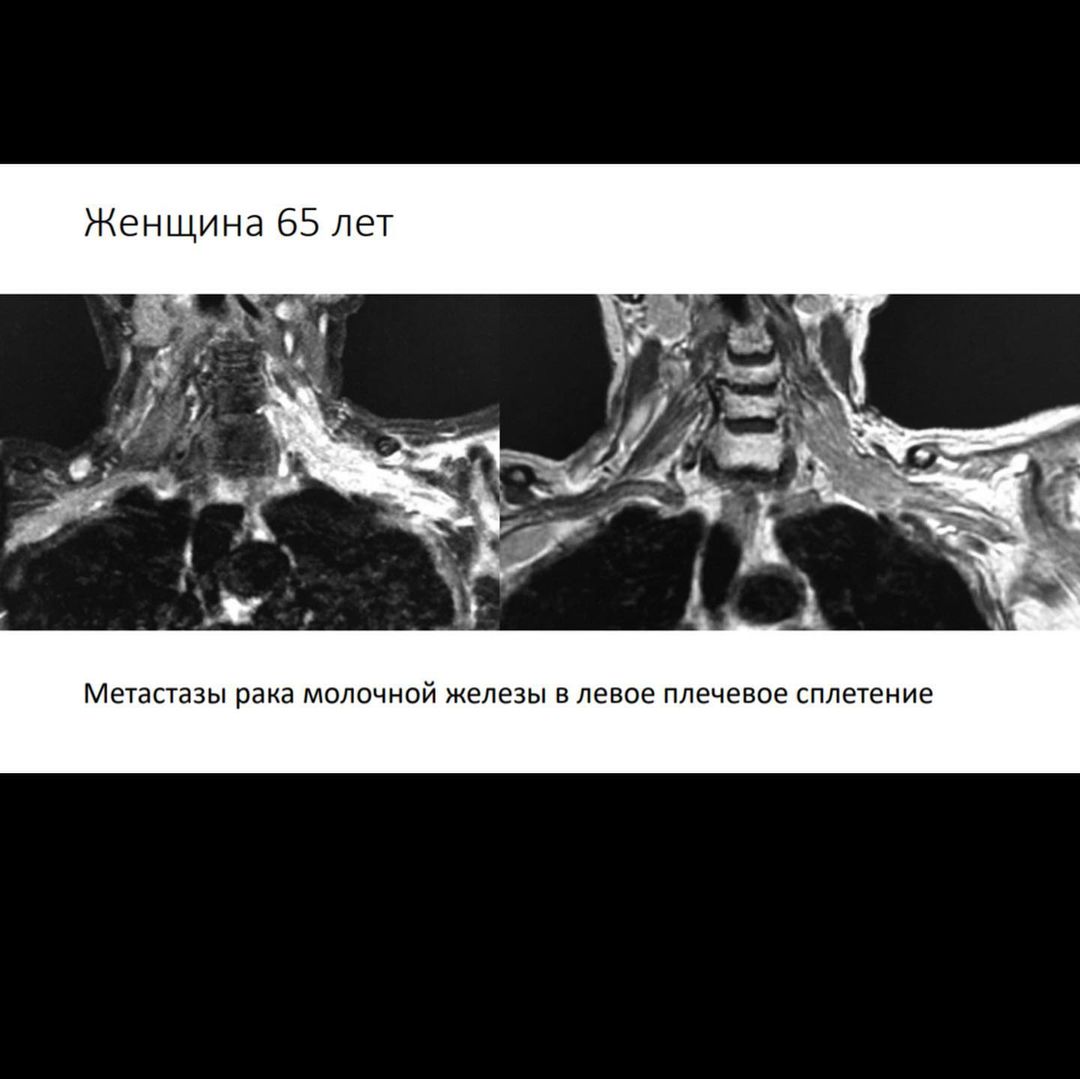 russianradiology в LOOKY — фото 5