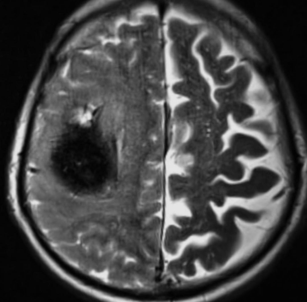 russianradiology в LOOKY — фото 6