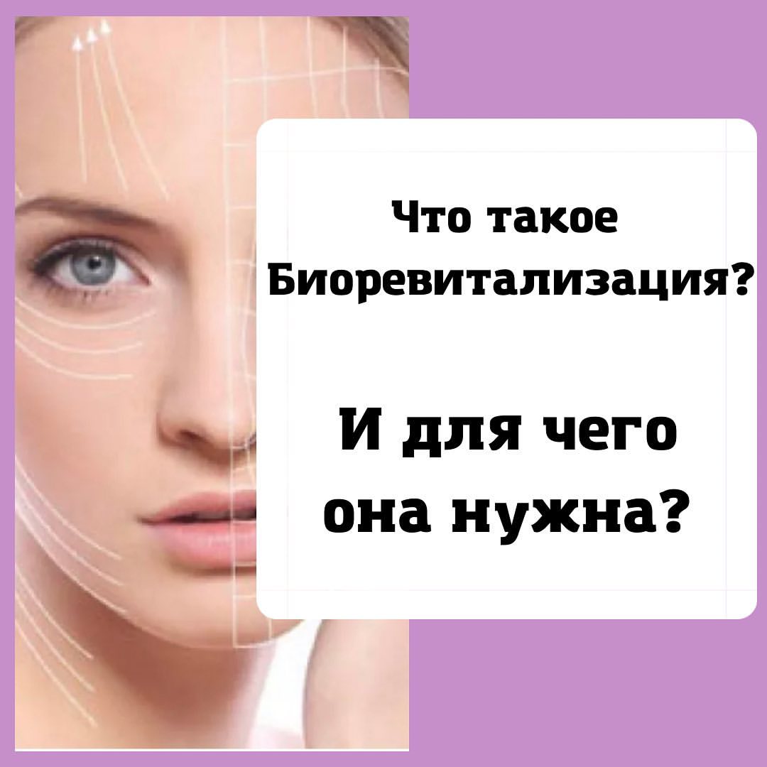 cosm_mayorova_lips в LOOKY — Биоревитализация – это процедура, направленная на борьбу с в