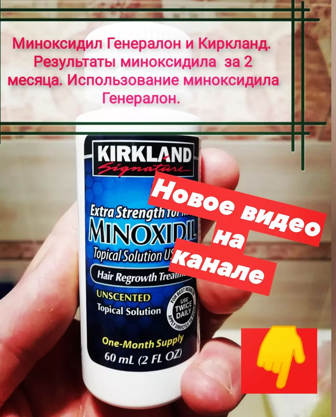 Записал новое видео на канале о использовании #миноксилила 

#миноксидилкиркланд
#миноксидил
#МиноксидилГенералон #Киркланд
#генералон
#полевской #екатеринбург #спорт #дмитрийштонденко
