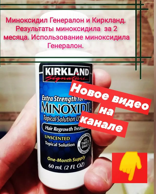 dmitryshtondenko в LOOKY. #миноксилила,#миноксидилкиркланд,#миноксидил,#МиноксидилГенералон,#Киркланд,#генералон,#полевской,#екатеринбург,#спорт,#дмитрийштонденко. Записал новое видео ...