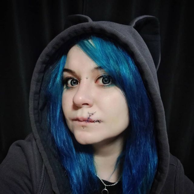 alx_nvsk в LOOKY. #stitch,#bite,#dogbite,#pitbullbite. А здесь я, пожалуй, ...