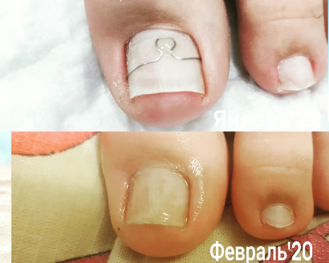 podolog.st.oskol в LOOKY — До: февраль'20 
После: январь'22

Результат работы с коррекц