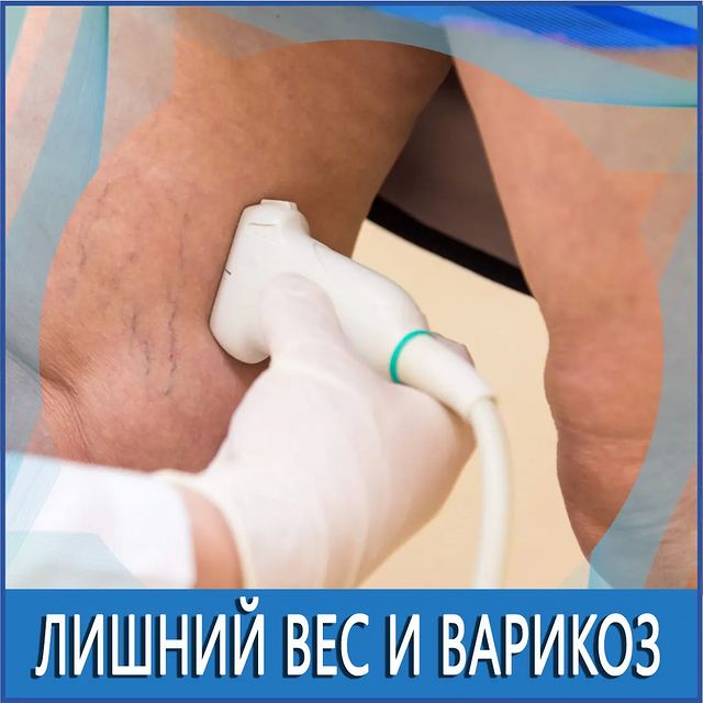 andreitempel в LOOKY. #здоровье,#красота,#гигрома,#шишка,#варикоз,#лечениеварикоза,#лазер,#эвло,#флеболог,#флебологкрасноярск,#тромбофлебит,#тромбоз,#трофическаяязва,#склеротерапия,#красноярскийкрай,#узивен,#красноярск,#кызыл,#хакасия,#эвлк,#варикозанет,#сосудистыезвездочки,#сосудистыйхирург,#крск,#врекомендации,#варикоз24,#беременностькрасноярск,#пауэрлифтинг,#абакан. 🚨 Избыточный или "л...
