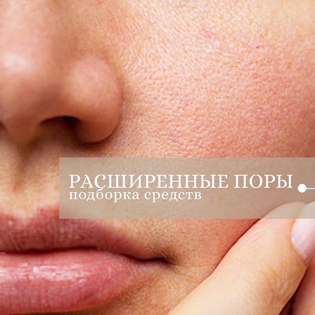est_anastasiya в LOOKY. #томск,#косметологтомск,#косметологэстетист,#косметология,#косметологиятомск,#уход,#sesderma,#sesdermarussia,#antiage,#косметологэстетист,#уходзалицом,#здороваякожа. ПОЛНОСТЬЮ избавиться...
