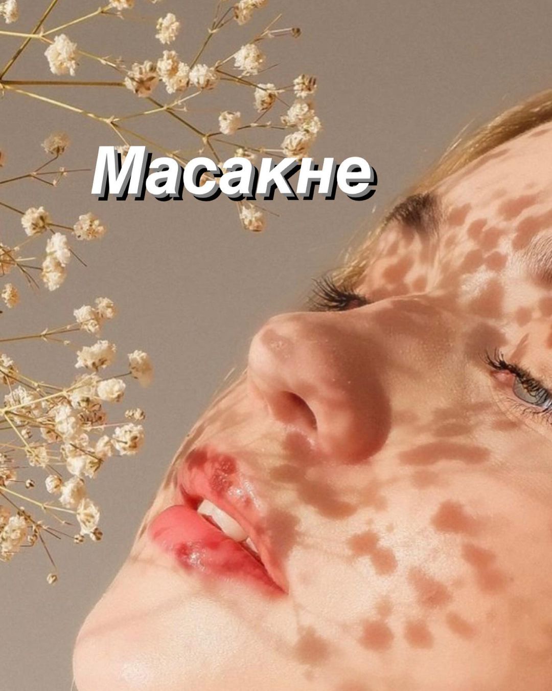 estetic_namtsy в LOOKY — Пандемия ввела новый термин - МАСКНЕ - 😷это состояние кожи,