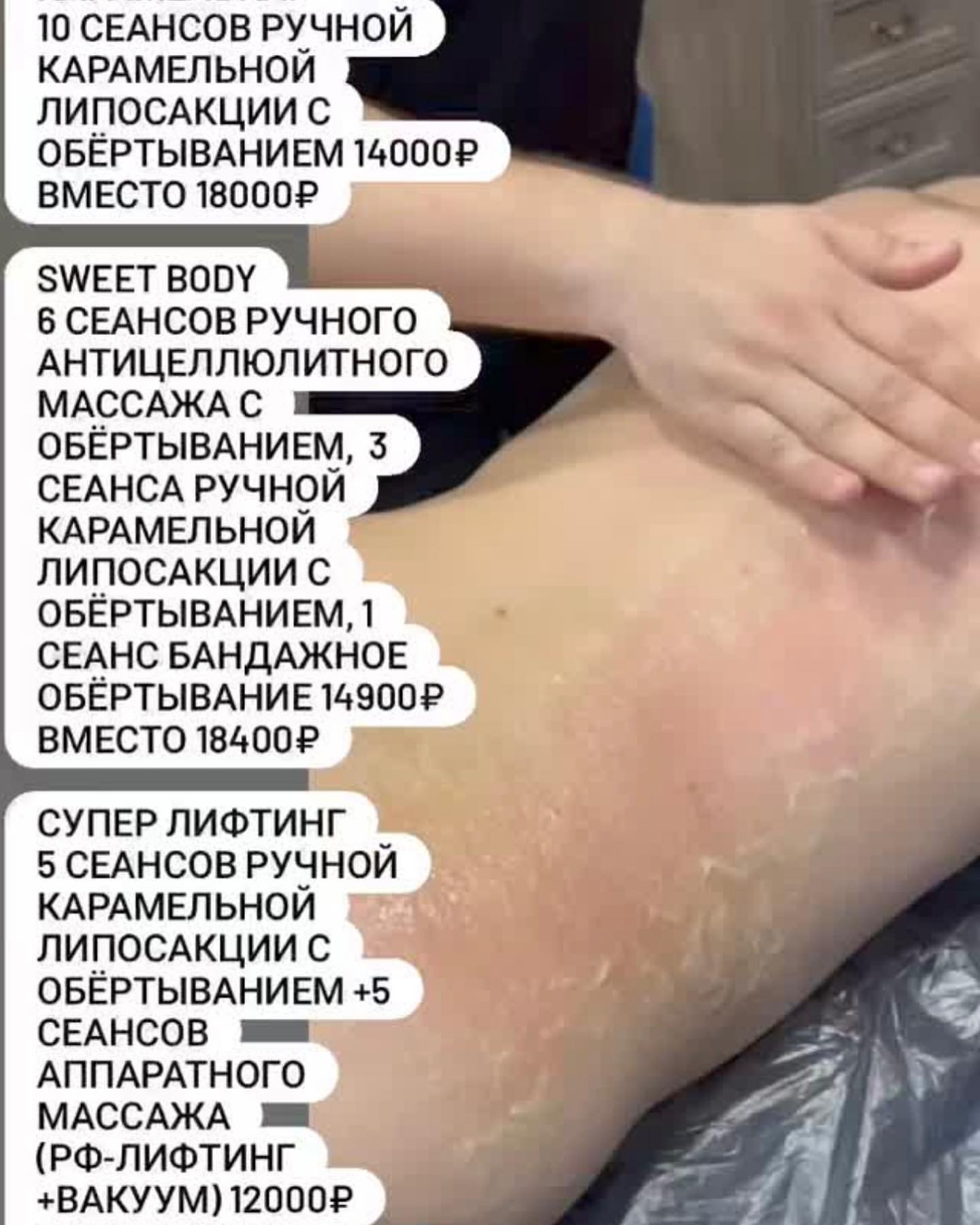 volodko_singer in LOOKY. #худеемклет. Карамельная липосакц...