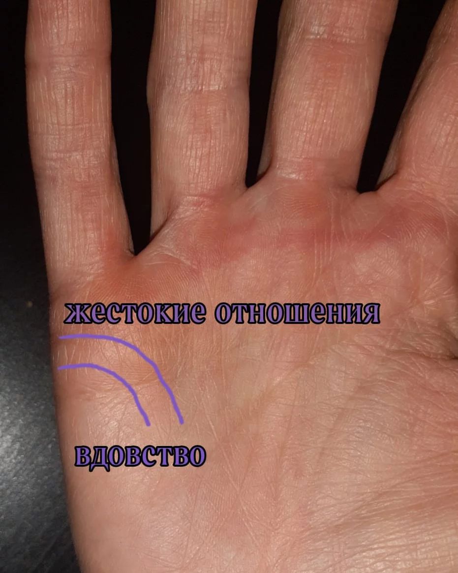 Когда нить души уходит в сторону головы, то это свидетельствует о жестоком отношении в семейной жизни.  Это может быть и применение физической силы,  и психическое давление на обладателя руки.

Если глубокая, выраженная брачная черта вдруг резко загибается вниз, это и есть так называемая вдовья линия — символ трагической потери избранника

Если черта брака заканчивается точкой, это означает внезапное вдовство

#хиромантия#таро#магия