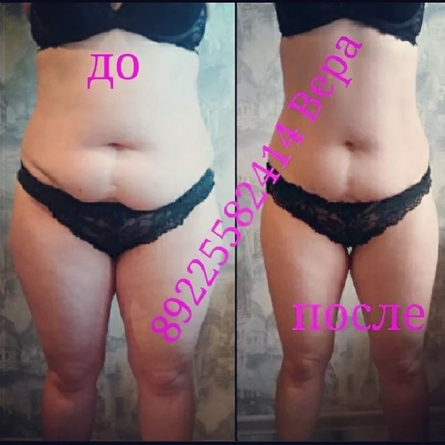massageinoren в LOOKY. #хочупохудеть,#хочукрасивоетело,#хочумассаж,#обертываниевподарок,#выезднадом,#массажоренбург,#массаждома,#будьтездоровы,#стройнеемсверой,#ненавреди,#комплексныйподход,#всемдобра✌,#massage,#xudeem,#stroineemveselo,#anticellulite,#мед,#массажувасдома,#доипосле,#профи,#худеемсбольшихобъёмов,#похудела,#массажорен,#талия,#результат,#люблюсвоюработу,#слюбовьюотvera,#massage,#xudeem,#марафон. Мои КРАСАВИЦЫ !!! Ес...