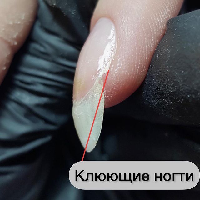 aleksanail_kor в LOOKY. #ногти,#форманогтей,#маникюр,#клюющиеногти,#постпроногти. Исправлять клюющие н...