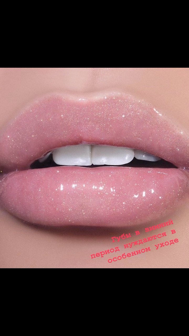 kosmetolog_estik_ekb в LOOKY. #косметология,#губы,#красота. #косметология#губы#к...