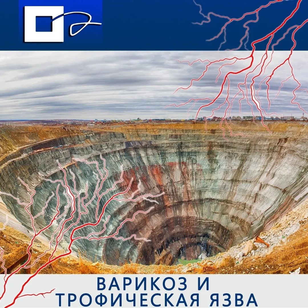 andreitempel в LOOKY — 💢Основная причина возникновения трофических язв — это варик