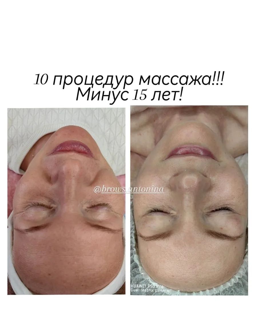 antonina.cosmetologist в LOOKY — фото 1