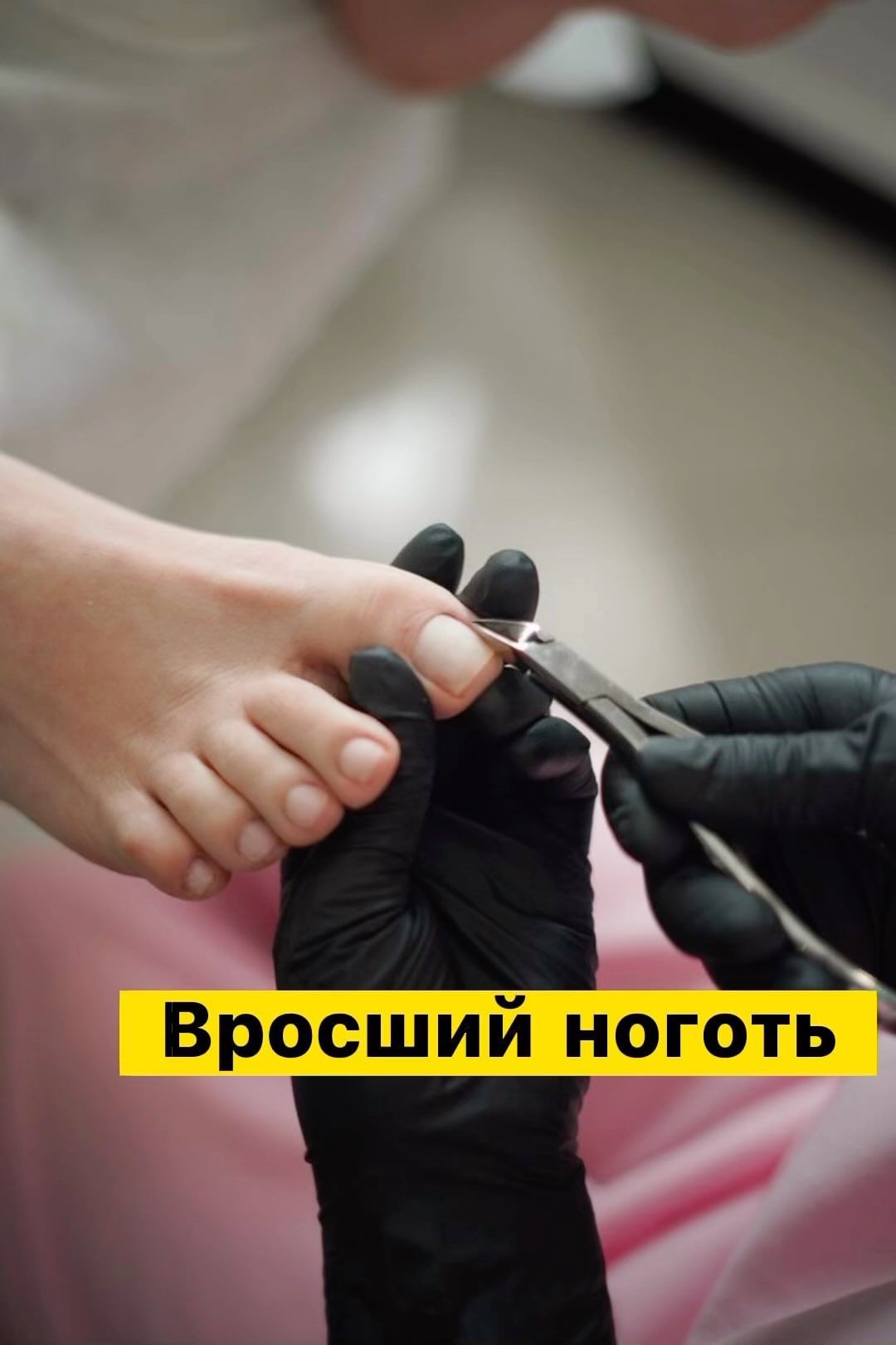 helen_podoexpert в LOOKY. #вросший,#титановая,#подологбратск,#подологэнергетик. С проблемой вросшего...