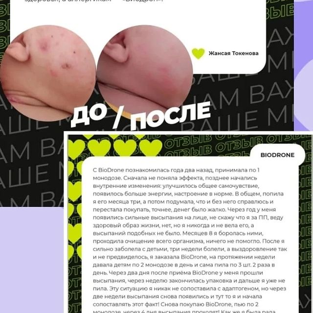 iluza0794 в LOOKY. . Отзывы  биодрона😘