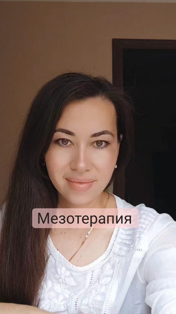 almira_atabayeva в LOOKY. #мезотерапия,#биоревитализация,#косметологташкент,#увлажнениекожи. #мезотерапия #биорев...