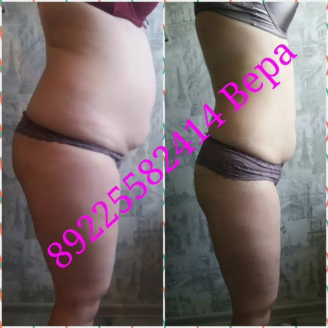 massageinoren в LOOKY. #хочупохудеть,#хочукрасивоетело,#хочумассаж,#обертываниевподарок,#выезднадом,#массажоренбург,#массаждома,#будьтездоровы,#стройнеемсверой,#ненавреди,#комплексныйподход,#всемдобра✌,#Vera,#massage,#xudeem,#stroineemveselo,#anticellulite,#мед,#массажувасдома,#доипосле,#профи,#худеемсбольшихобъёмов,#похудела,#массажорен,#талия,#результат,#люблюсвоюработу,#слюбовьюотvera,#massage,#xudeem,#марафон. Во время выполнения ...