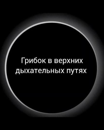 bioresonance_msk в LOOKY. #биорезонансмосква,#биорезонанс,#паразиты,#грибы,#натуропатия,#нутрициология,#брт,#здоровье,#candida,#питание,#сахар,#молочка,#пп. Грибы не только в ле...